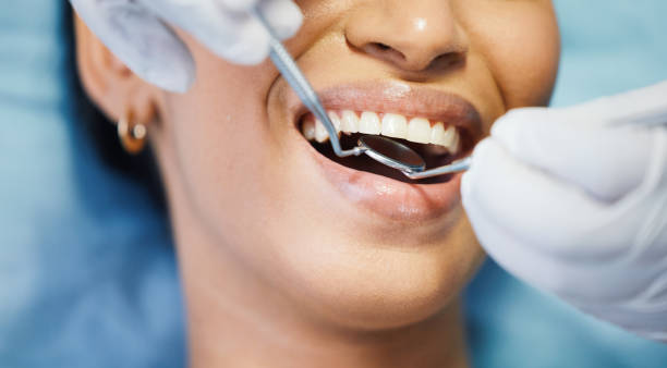 Best Emergency Dentist for Knocked-Out Tooth in Fox Lake, WI